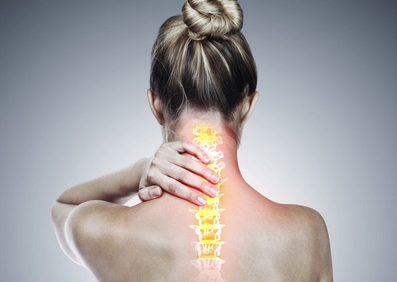 Osteochondrozė