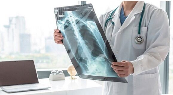 Rentgeno diagnostika dėl skausmo po kairiuoju pečių ašmenimis