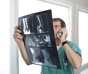Mielografija osteochondrozės ir tarpslankstelinių išvaržų diagnostikai