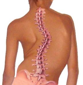 Stuburo kreivumas sukelia osteochondrozę