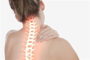 Moterų gimdos kaklelio osteochondrozė